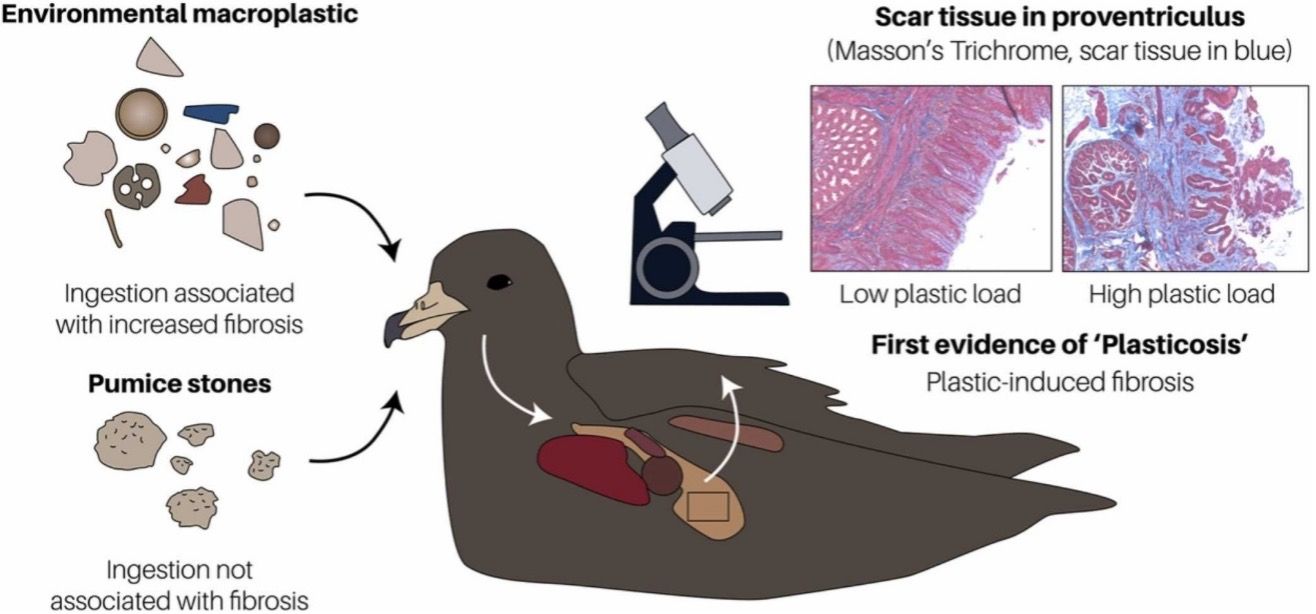 Illustration depicting plasticosis syndrome in a seabird's internal system, highlighting the effects of plastic ingestion on digestive organs and overall health.
